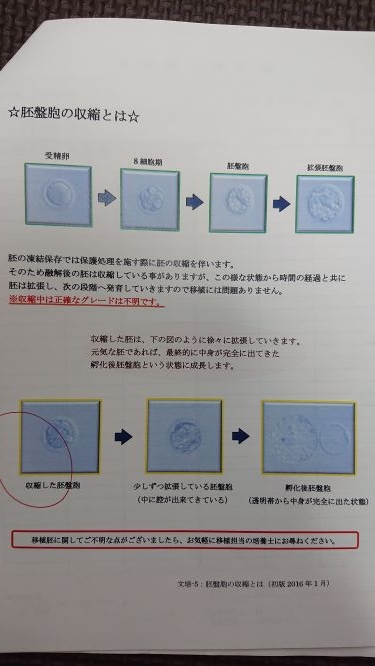 胚盤胞の収縮、胚盤胞